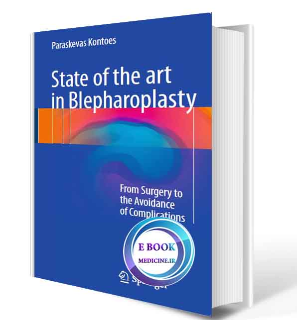 دانلود کتاب State of the art in Blepharoplasty: From Surgery to the Avoidance of Complications2017 ( ORIGINAL PDF)